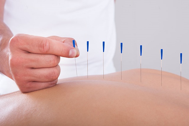 How Alternative Therapies Like Acupuncture Help With Diabetes